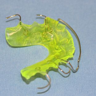 Herausnehmbare Zahnspange speziell für Kinder